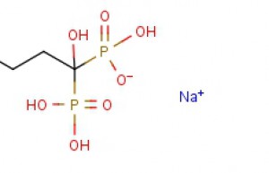 Alendronate Sodium